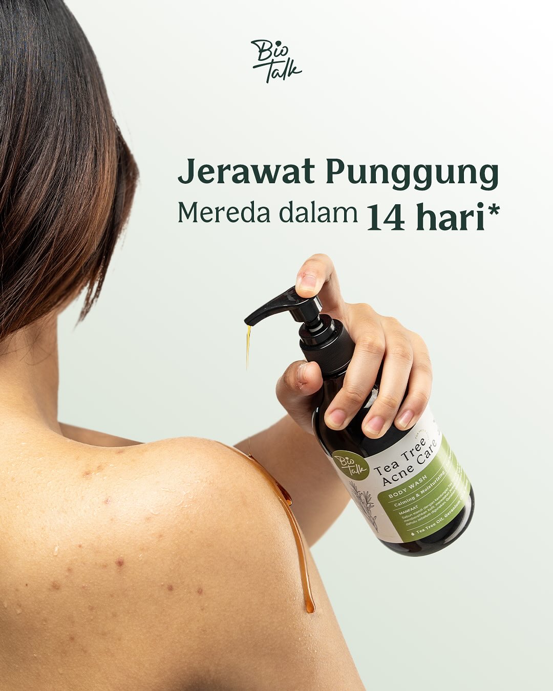 Pernah ngerasa jerawat kamu di punggung gatal dan bikin commute gak nyaman 😢Kamu nggak sendiria